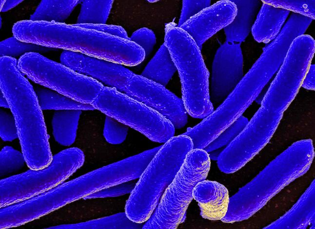 E. coli provoca mais frequentemente o desenvolvimento de cistite em mulheres